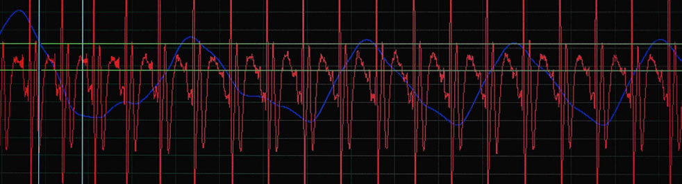 Dr. June Gruber - Yale Psychology - Research Methods in Happiness - Psych 231